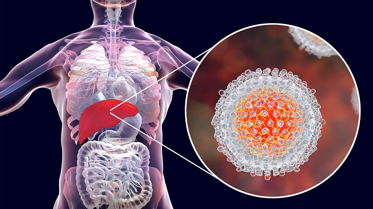 Surto de hepatite A já atingiu 366 pessoas